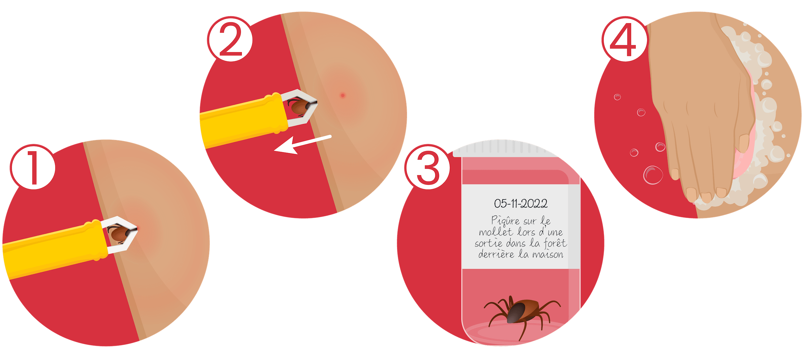 Ticks